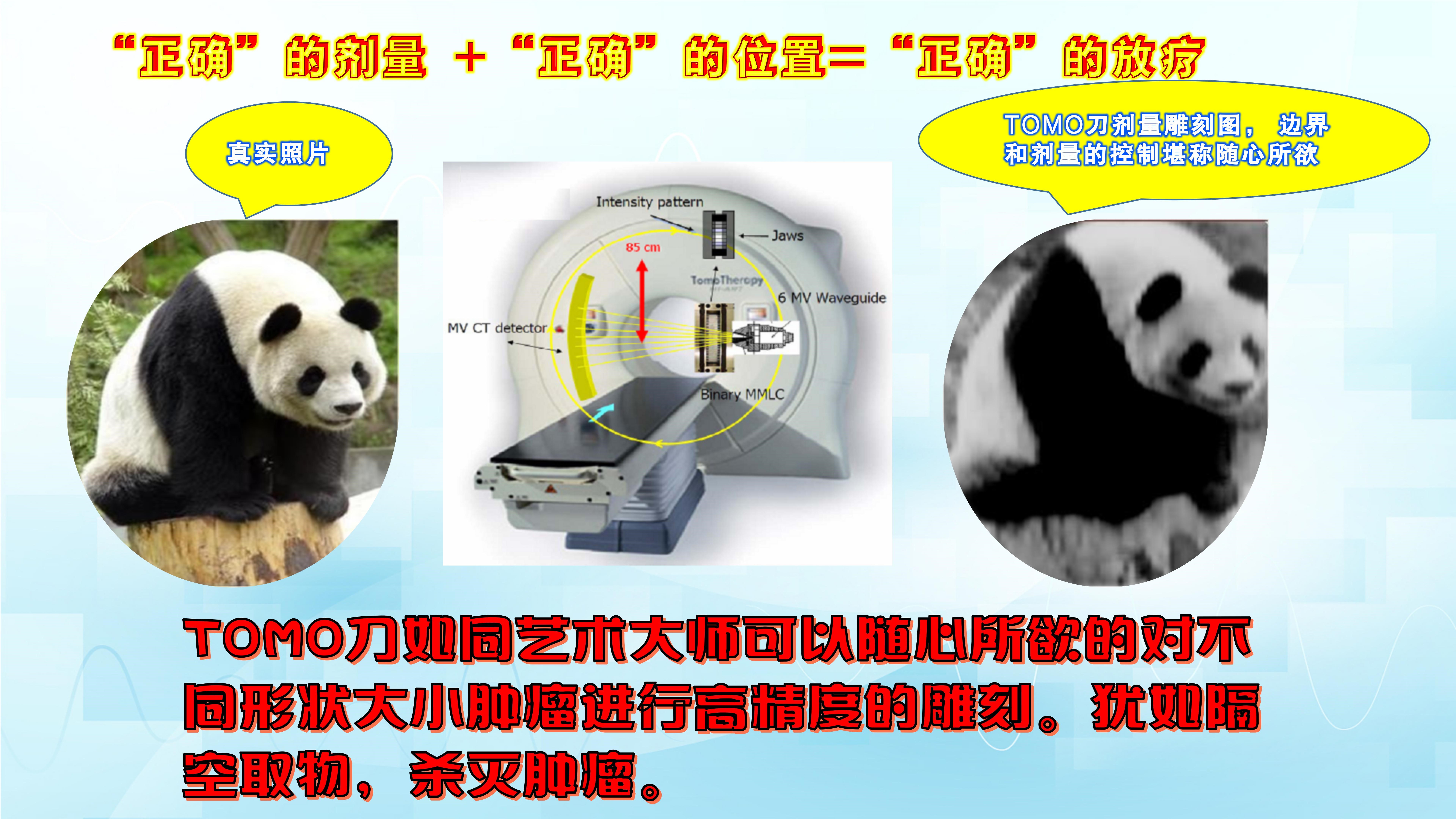 TOMO HD放疗系统具有超强大的放疗功能,堪称肿瘤放疗的利器!